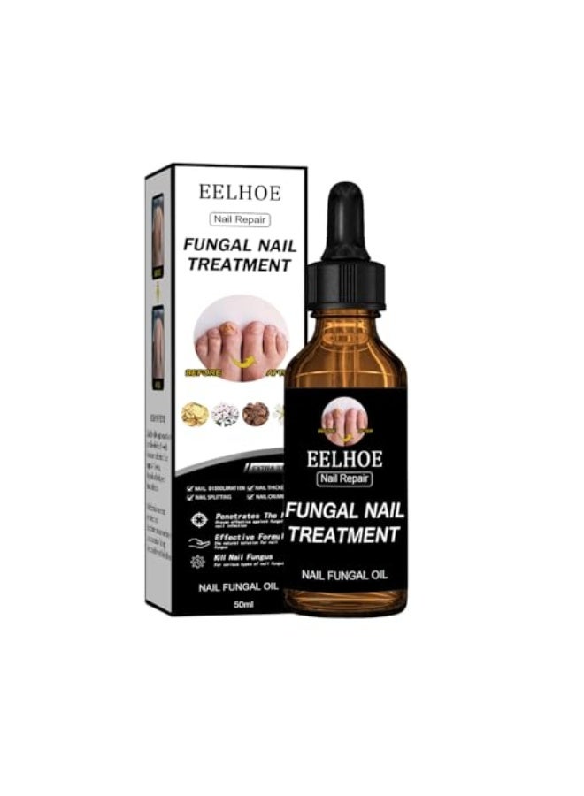 EELHOE Nail Repair Fungal Nail Treatmnt ,Toenail Fungus Treatment Extra Strength – Nail Fungal Oil with Glycerin & Panthenol, 4 Pure Natural Plant Extracts, Fung Damaged Nails, Discoloration Nails, Nail Psoriasis, Nails Aging, 50ml - Image 1