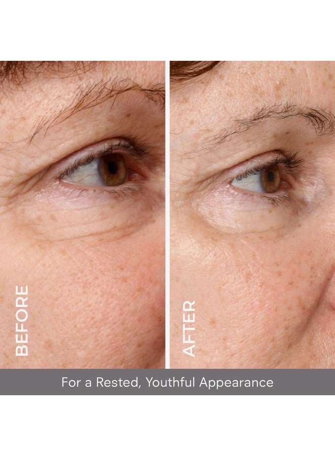 كوزميديكس سيروم كوزميدكس تحت العين لعلاج الهالات السوداء والانتفاخات، أوبتي كريستال - سيروم سائل لشد البشرة وشدها، لعلاج الخطوط الدقيقة والتجاعيد - سيروم مُشرق ومرطب ومُضاد للشيخوخة، يُعالج انتفاخات العين. - Image 3