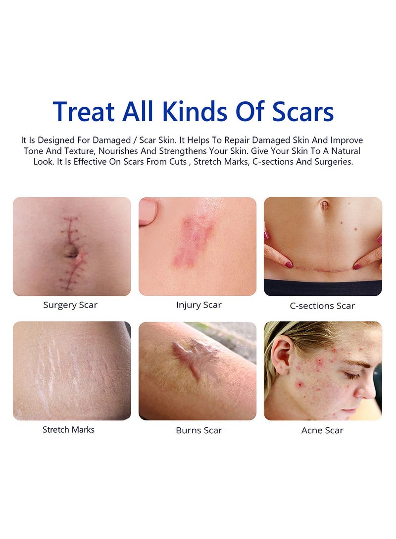 Scar Removal Cream with 2% Dimethicone Complex Quick Effect for  New and Old Pregnancy Scald and Operation Scar to Repair Damage Skin and Nourish and Brighten Skin 50ML