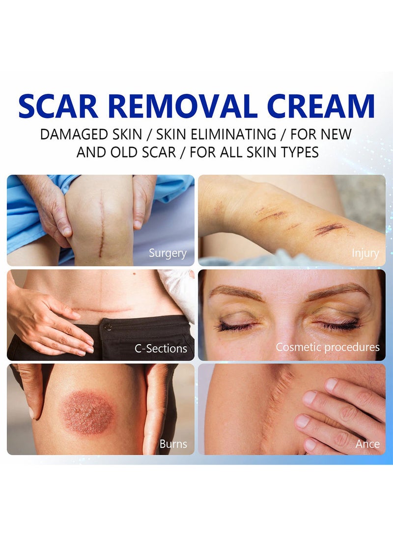 Scar Removal Cream with 2% Dimethicone Complex Quick Effect for  New and Old Pregnancy Scald and Operation Scar to Repair Damage Skin and Nourish and Brighten Skin 50ML