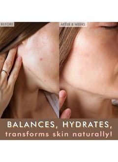 Beauty by Earth Organic Face Oil Natural Anti Aging Facial Oil With Centella Asiatica Rosehip Oil For Sensitive Skin Argan Oil For Gua Sha Massage Jojoba Oil And Vitamin E Day And Night Moisturizer For Dry Skin  - Image 2