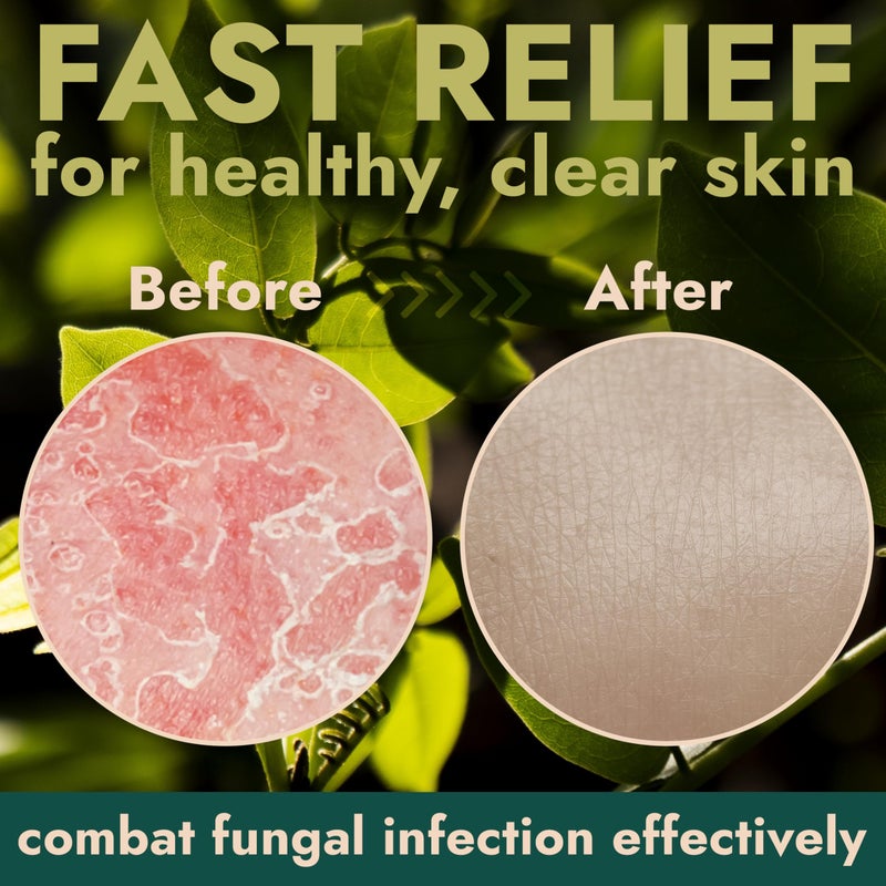 Terramed Just Think Comfort Antifungal Soap | Medicated Jock Itch Treatment, Fights Ringworm & Athlete's Foot | Soothing Tea Tree & Eucalyptus | 1% Tolnaftate for Effective Relief | Travel-Friendly with Soap Case - Image 4