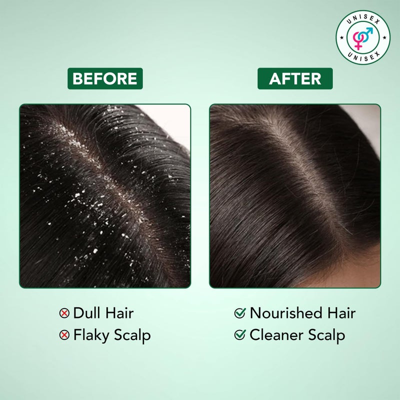 Botanic Hearth Tea Tree Shampoo and Conditioner Set | with 100% Pure Tea Tree Oil, for Itchy and Dry Scalp, Sulfate/Paraben Free | for Men and Women | 16 Fl Oz Each - Image 5