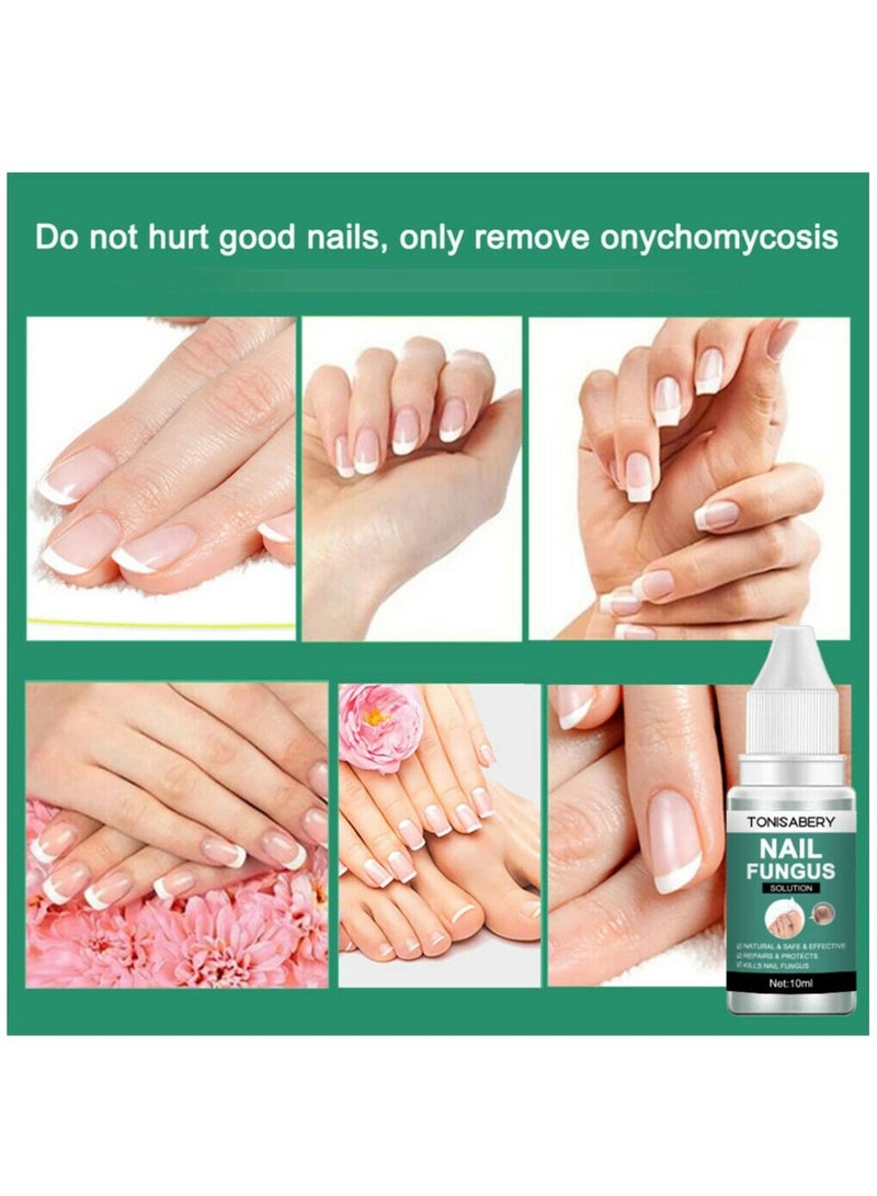 TONISABERY مصل إصلاح الأظافر الفطرية للعناية بالقدمين وعلاج الفطريات في الأظافر - Image 4
