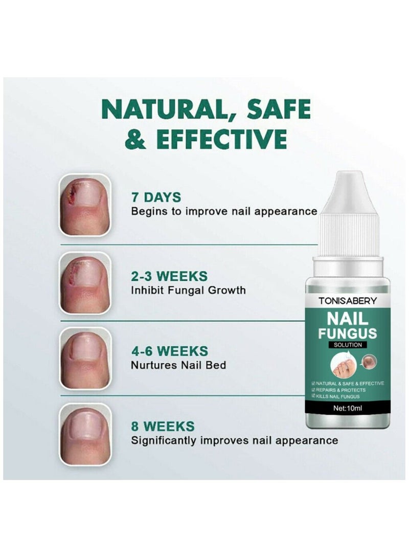 TONISABERY مصل إصلاح الأظافر الفطرية للعناية بالقدمين وعلاج الفطريات في الأظافر - Image 3