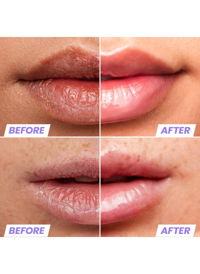 Wonderskin - Lip Oil Lip Rehab Serum Oil Hydrating And Moisturizing Clear Lip Oil For Dry Lips Natural Vegan And Nonsticky Lip Gloss Oil - Image 1