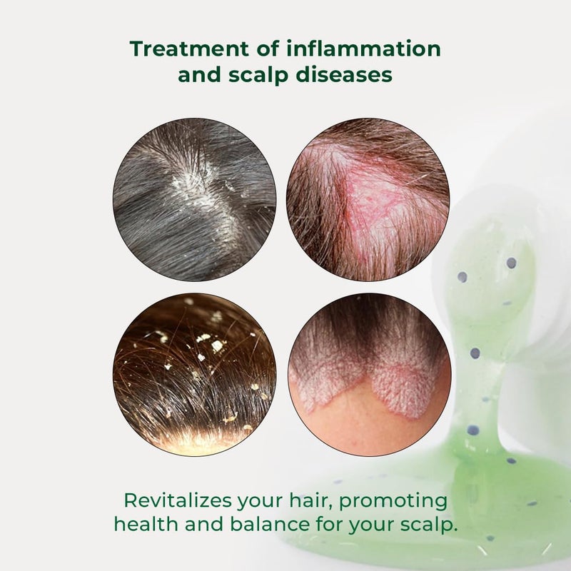 Sweet Professional Detox Hydrating Gel Hair Mask - Hair & Scalp Oilness Control, Protection & Nourishment, Hair Care Products for Women - VEGAN, Green Clay, Red Seaweed Extracts - 7.05oz - Sweet Pro - Image 4