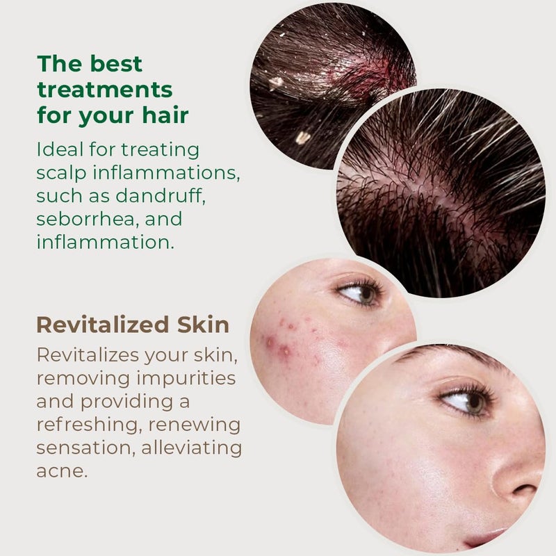 Sweet Professional Detox Hydrating Gel Hair Mask - Hair & Scalp Oilness Control, Protection & Nourishment, Hair Care Products for Women - VEGAN, Green Clay, Red Seaweed Extracts - 7.05oz - Sweet Pro - Image 2