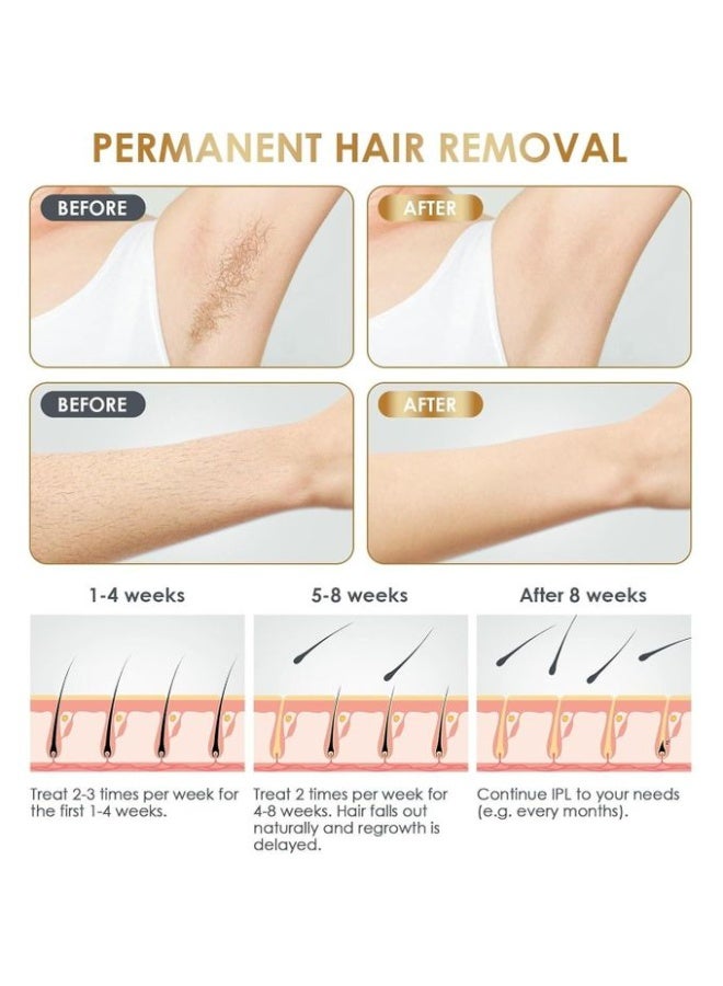 جهاز إزالة الشعر بالليزر IPL للاستخدام المنزلي للنساء والرجال - Image 3