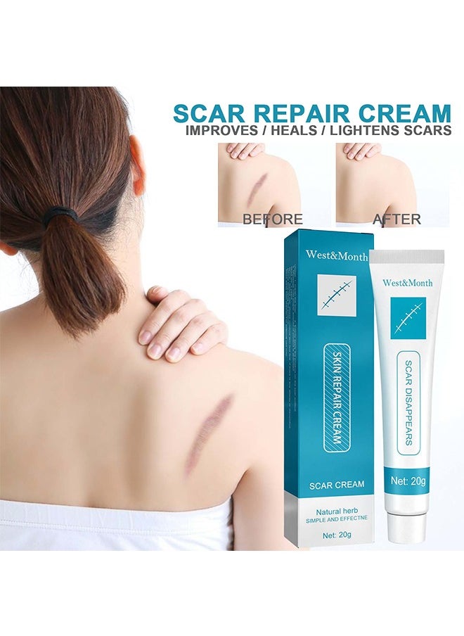 West&Month - Scar repair cream,dilute hyperplasia pregnancy surgery burn scald skin repair scar cream 20g - Image 1
