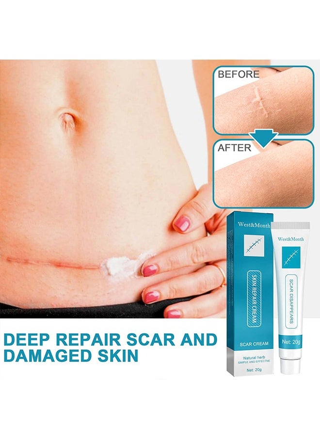 West&Month - Scar repair cream,dilute hyperplasia pregnancy surgery burn scald skin repair scar cream 20g - Image 1