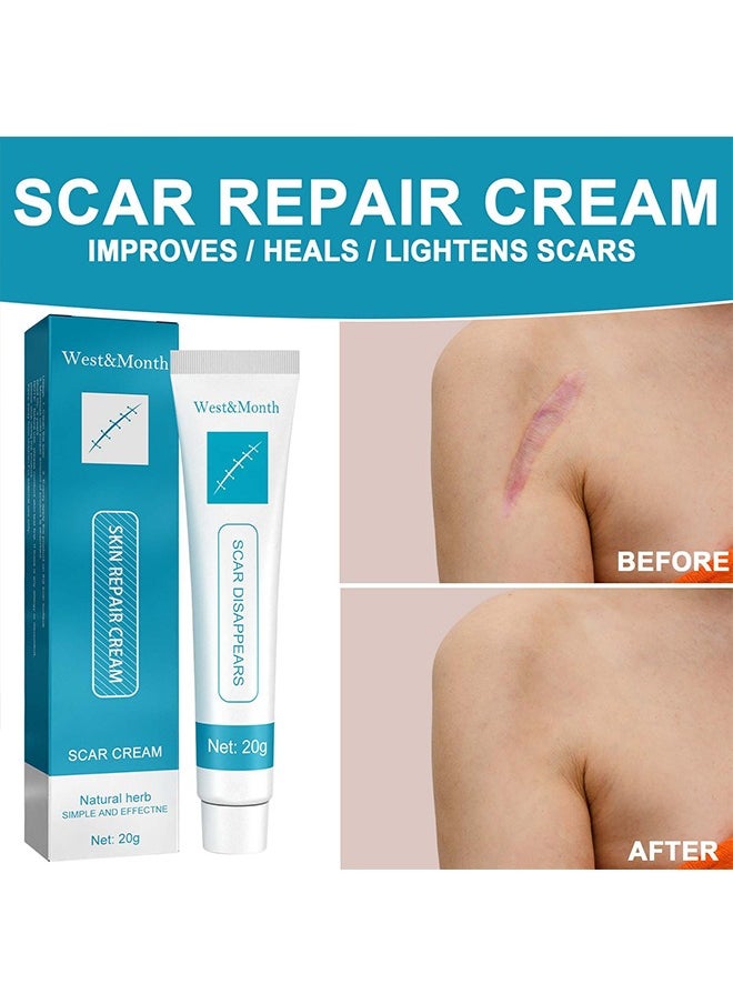 West&Month - Scar repair cream,dilute hyperplasia pregnancy surgery burn scald skin repair scar cream 20g - Image 1