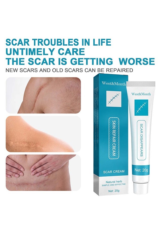 West&Month - Scar repair cream,dilute hyperplasia pregnancy surgery burn scald skin repair scar cream 20g - Image 1