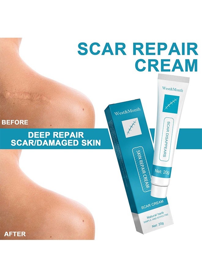 West&Month - Scar repair cream,dilute hyperplasia pregnancy surgery burn scald skin repair scar cream 20g - Image 1