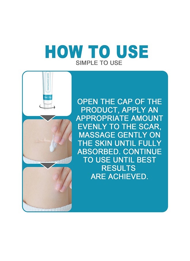 West&Month - Scar repair cream,dilute hyperplasia pregnancy surgery burn scald skin repair scar cream 20g - Image 1