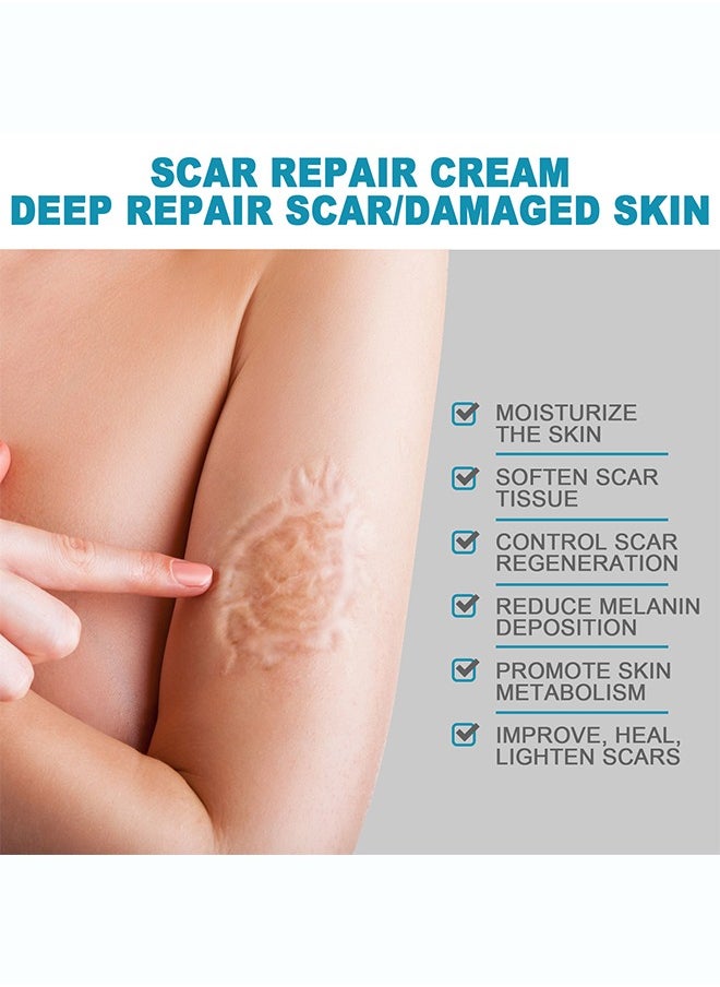 West&Month - Scar repair cream,dilute hyperplasia pregnancy surgery burn scald skin repair scar cream 20g - Image 1