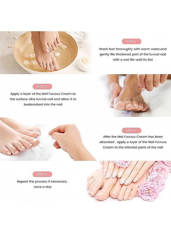 DERMFREE Nail Toenail Cream，Nail Repair Cream, 20g Nail Cream Anti Harmful Substance Repair Finger Toe Nail Care Perfect for Men and Women Home Use - Image 5