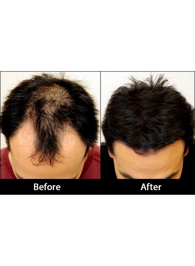 Rebuilds Hair Fibers Light Brown 27 Grams - Image 5