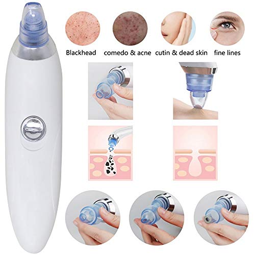 Lilium D-Oxy Tan Removal Scrub and Face Pack (275g) with Blackhead Remover Tool – Deep Cleansing Facial Kit for Radiant & Even Skin Tone – Sulfate & Paraben Free – Dermatologically Tested - Image 5