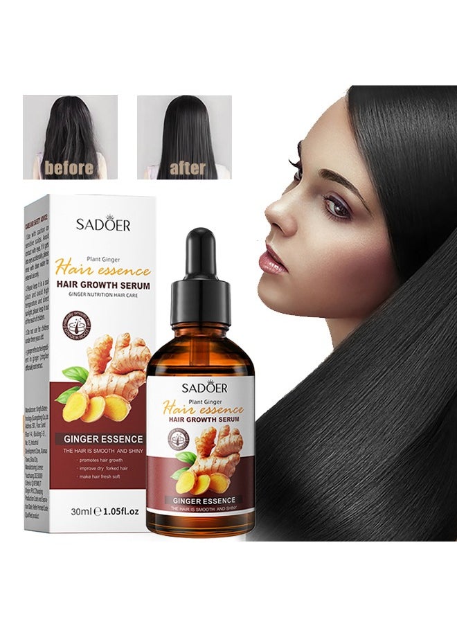 SADOER - Plant Ginger Hair Growth Serum，Hair Growth Serum for Hair Loss, for Dry, Damaged Hair, Enhance Hair Elasticity and Toughness 30ml - Image 1