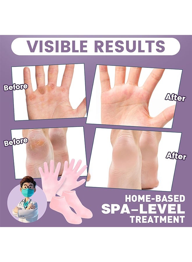 2 Pairs Silicone Socks Gloves Set for Dry Cracked Feet and Hands Silicone Foot Socks for Men Women Moisturizing Feet Beige - Image 3