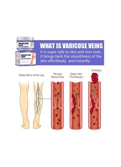 Generic West Month Varicose Veins Cream 30g  - Image 2