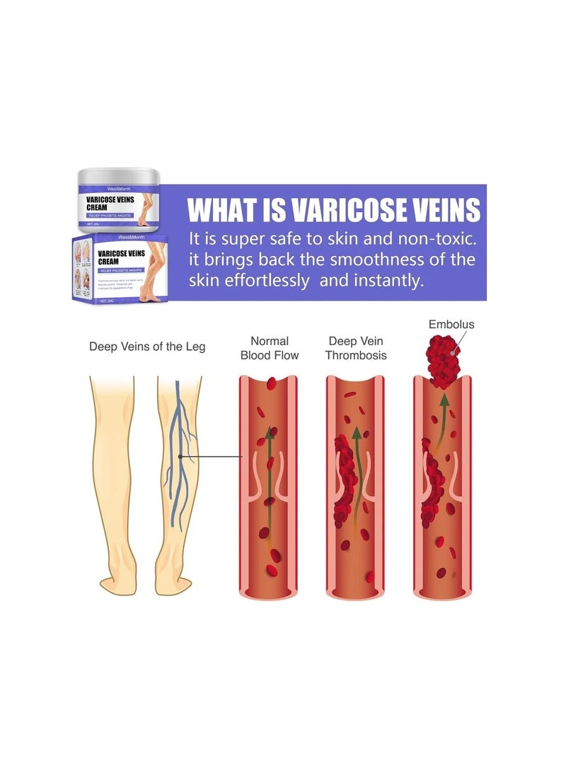 Generic West Month Varicose Veins Cream 30g  - Image 2