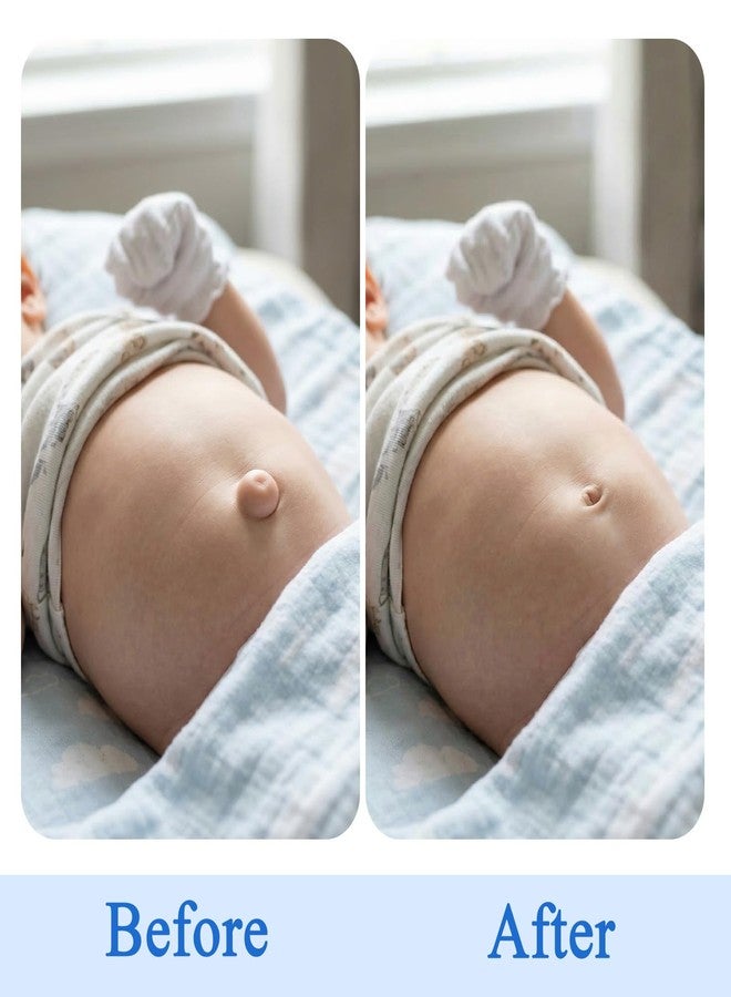 JFRHUDS Baby Belly Button Band with 15Pcs Navel Patches for Newborn - Image 5