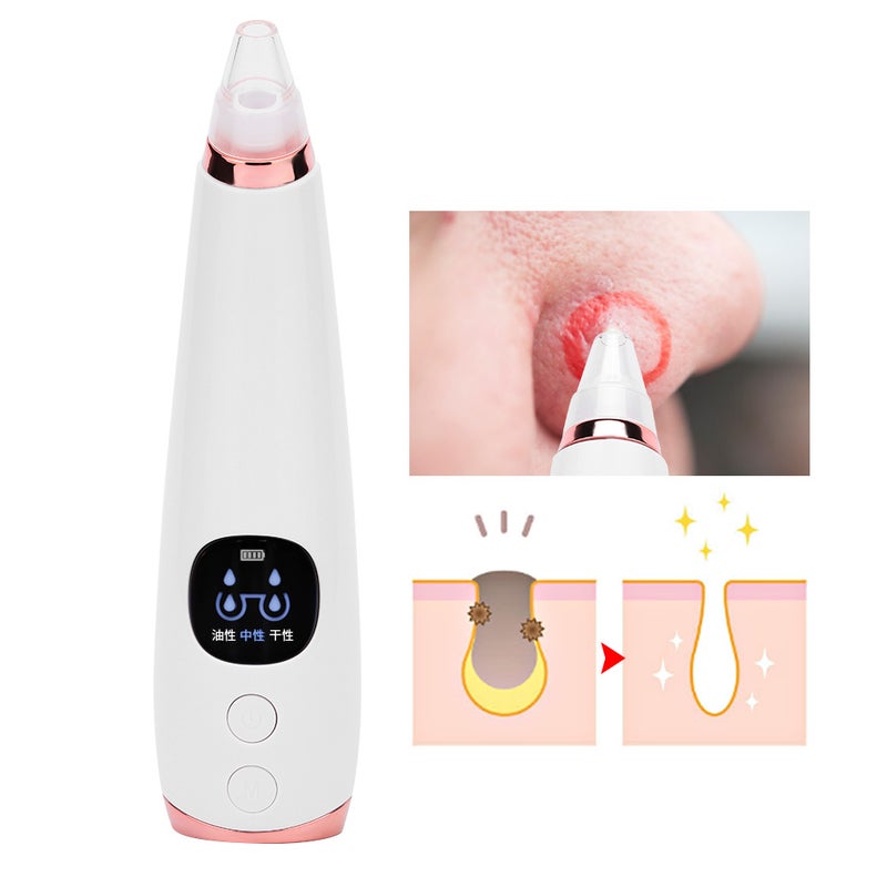 Electric Vacuum Suction Blackhead Removal Face Pore Cleaner Skin Peeling Machine - Image 5