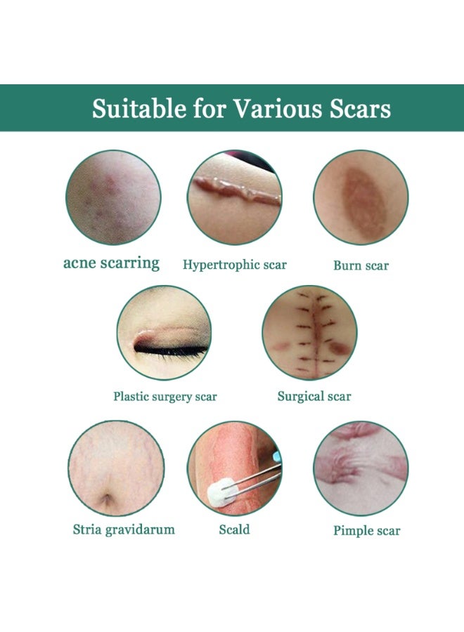 EELHOE Lighten Scar Smooth Skin Cream - Image 2