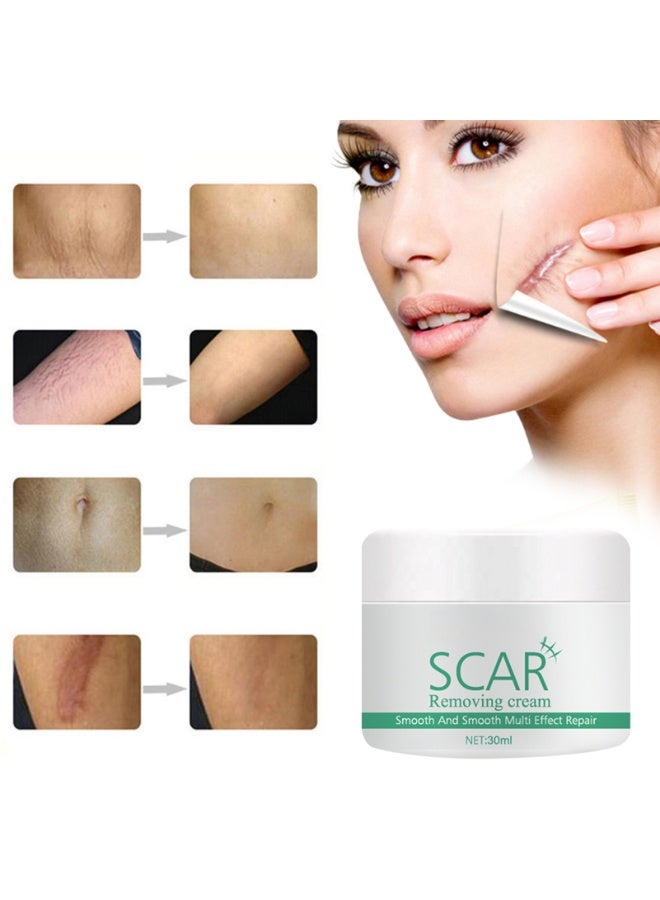 EELHOE Lighten Scar Smooth Skin Cream - Image 4