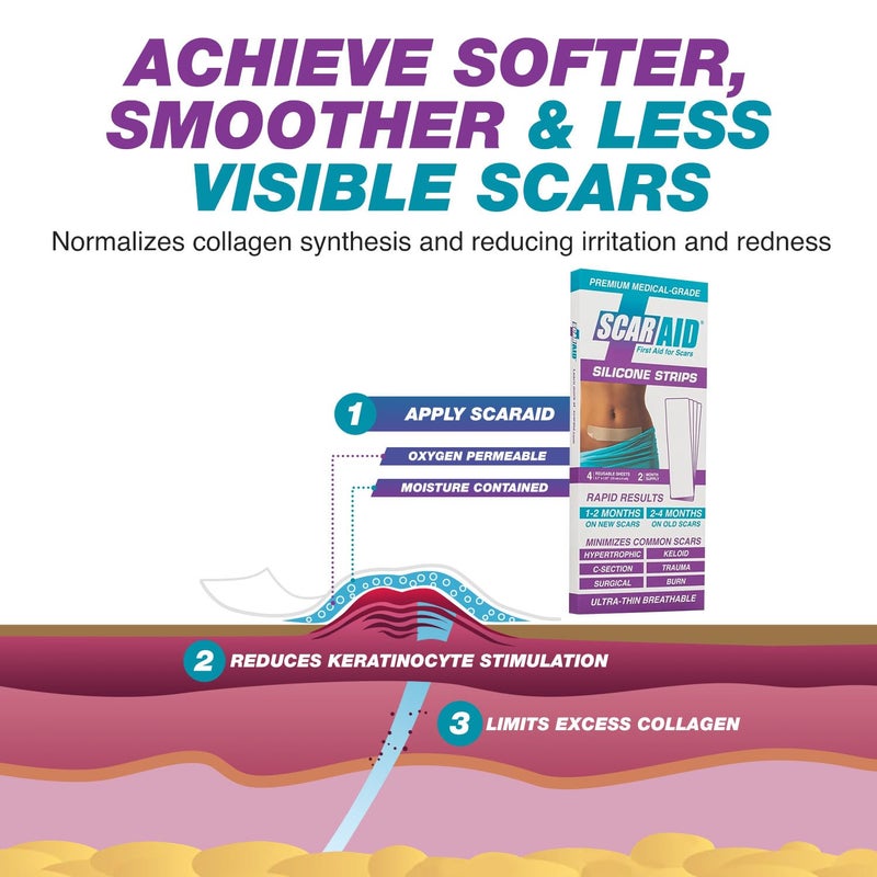 ScarAid أوراق جل السيليكون لعلاج الندبات - مثبتة سريرياً - قابلة لإعادة الاستخدام، قابلة للغسل وقابلة للتخصيص لندبات أكثر سلاسة ونعومة - مثالية للندبات الجديدة والقديمة - آمنة لجميع أنواع البشرة - Image 5