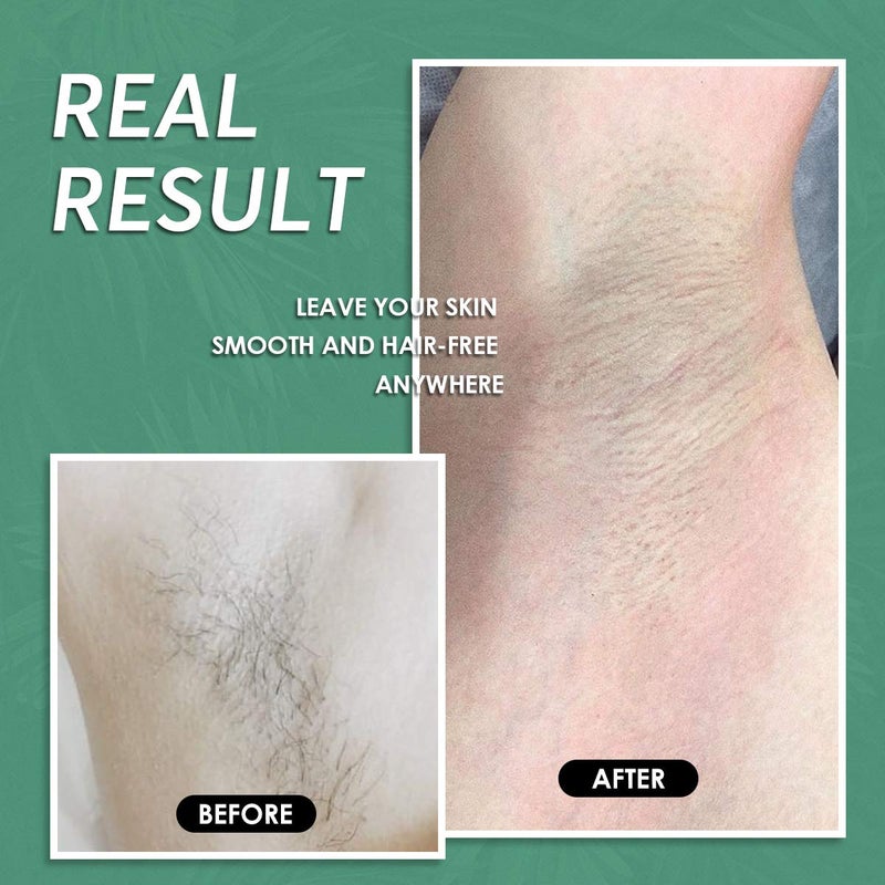 Maxpearl Wax Beads for Hair Removal, 2.5lb Hard Wax Beans Refill Bag for Brazilian Bikini, Face, Eyebrows, Underarms, Arms, Chest, Back, Legs, Coarse Body Hair Specific - Image 5