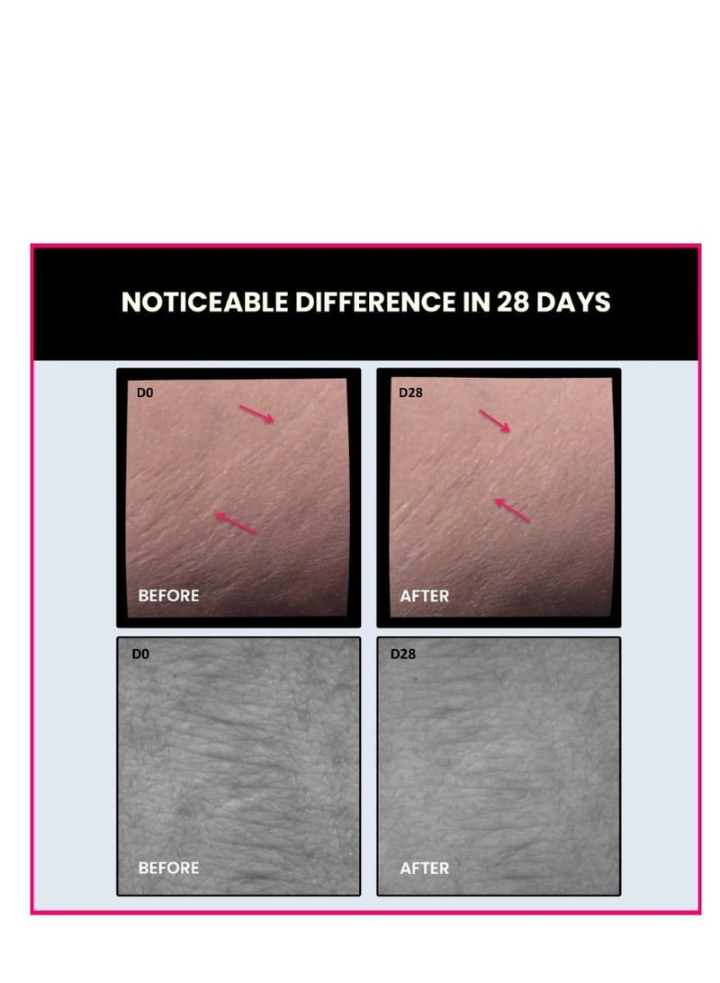 ThriveCo Stretch Marks Expert Serum Cream | Prevents & Reduces Appearance of New (Red) and Old (White) Stretchmarks | Powered by Striover™, Rosehip Oil & Squalane | Vegan and Cruelty-free | For Men & Women | 30ml (Pack of 2) - Image 1