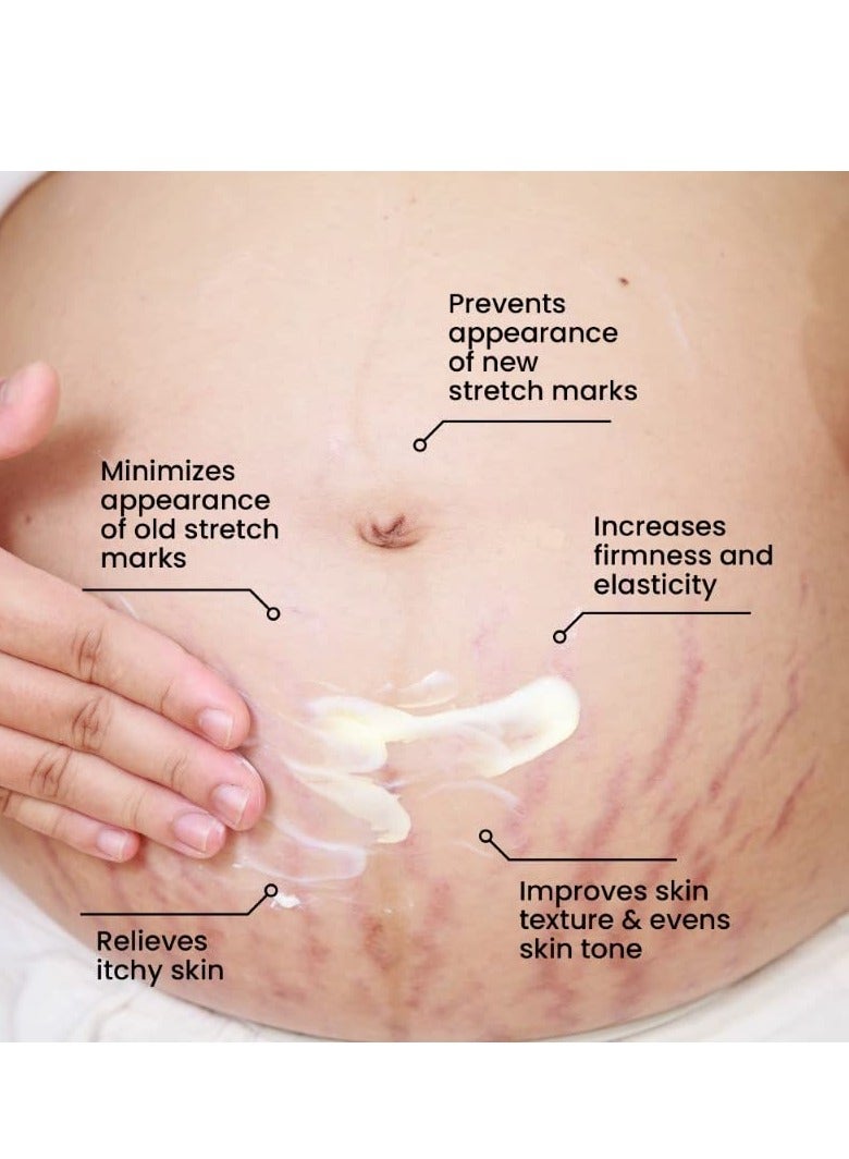 ThriveCo Stretch Marks Expert Serum Cream | Prevents & Reduces Appearance of New (Red) and Old (White) Stretchmarks | Powered by Striover™, Rosehip Oil & Squalane | Vegan and Cruelty-free | For Men & Women | 30ml (Pack of 2) - Image 5