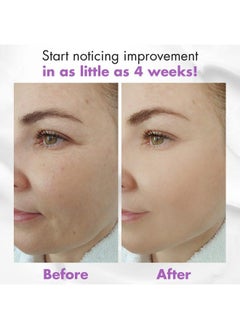 Beauty by Earth Anti Aging Face Moisturizer For Women Bakuchiol Retinol Alternative Hydrating Face Moisturizer Wrinkle Cream For Face Face Cream For Women Anti Aging The Best One Anti Wrinkle Face Cream  - Image 5