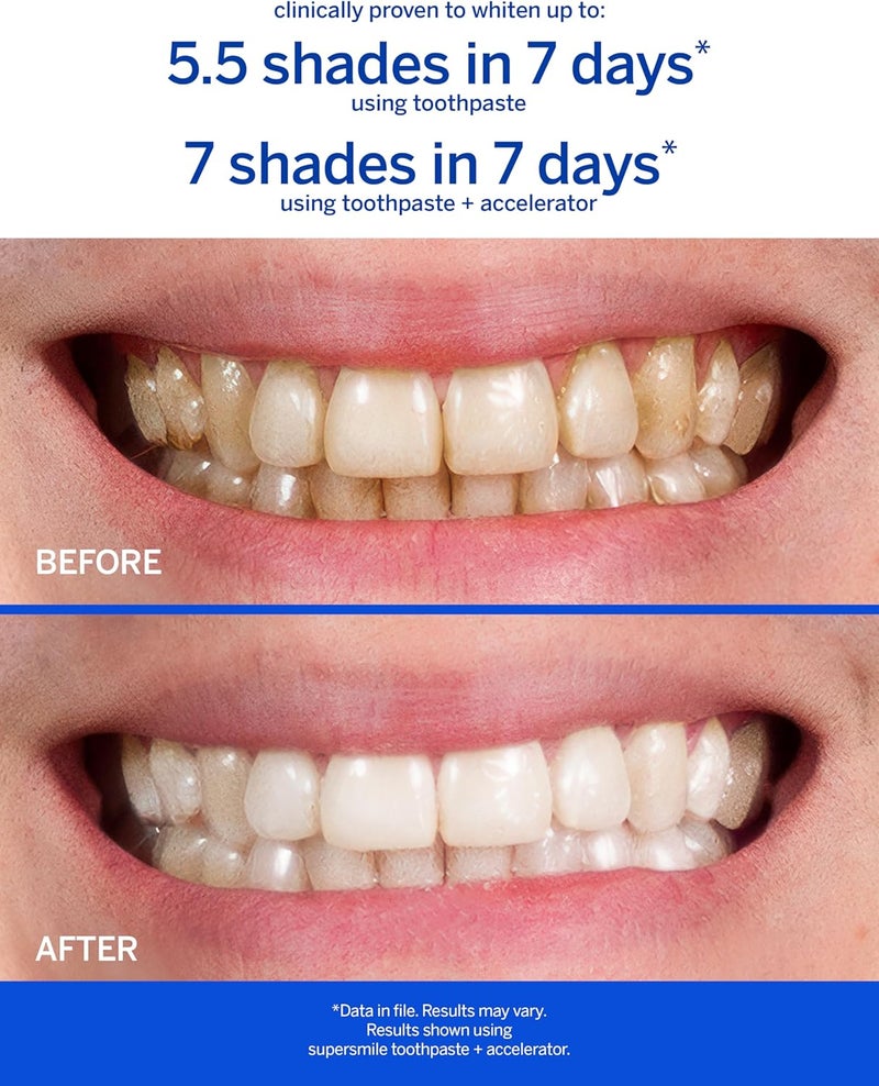 Supersmile Professional Whitening System - Image 3
