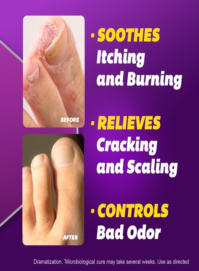 Silka Antifungal Cream, Clinical Anti-Fungus Foot Treatment, Results in 1 Week, Maximum Strength Athlete’s Foot Treatment, Jock Itch, Ringworm Treatment for Humans, Terbinafine Cream, 1oz- 2 Pack - Image 3