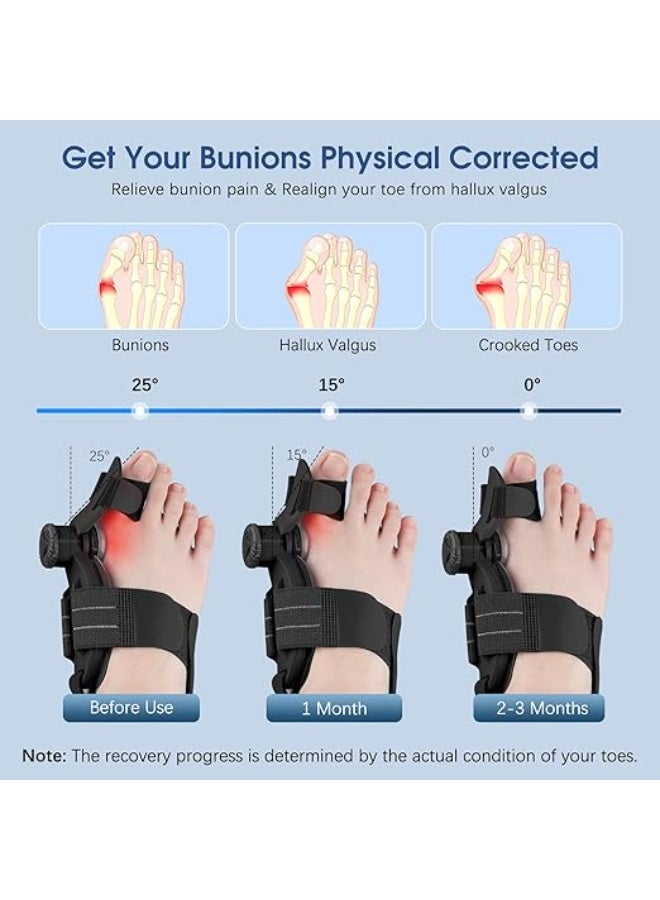 Bunion Corrector for Women & Men – Adjustable Orthopedic Splint with Big Toe Separator – Easy-to-Use for Hallux Valgus Correction & Pain Relief - Image 3