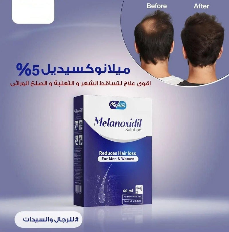 Melano Pharma Melanoxidil 5% Hair Regrowth Treatment 60 ml - Image 4