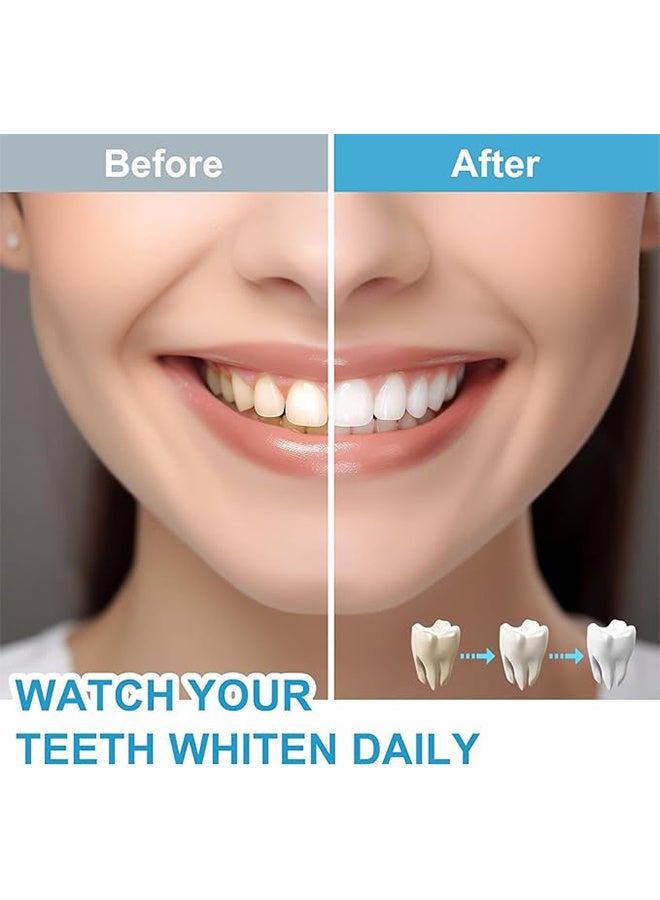 Glory Smile Teeth Whitening Light with Mouth Trays, 10 Min Fast Teeth Whitener, with 3 Pcs Teeth Whitening Gel, Helps to Remove Stains from Coffee, Smoking, Wines, Soda, Food - Image 2