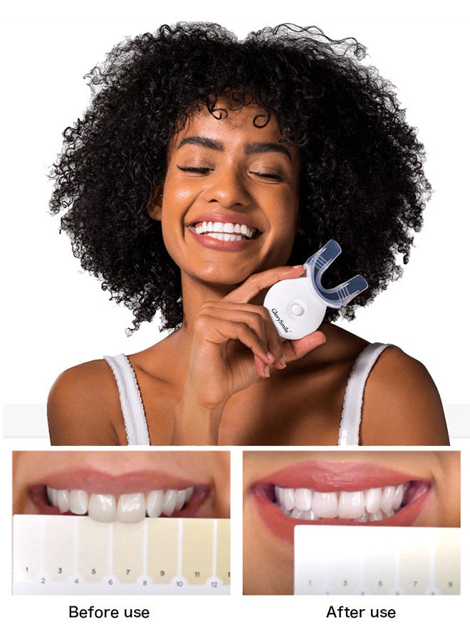 Glory Smile Teeth Whitening Light with Mouth Trays, 10 Min Fast Teeth Whitener, with 3 Pcs Teeth Whitening Gel, Helps to Remove Stains from Coffee, Smoking, Wines, Soda, Food - Image 5