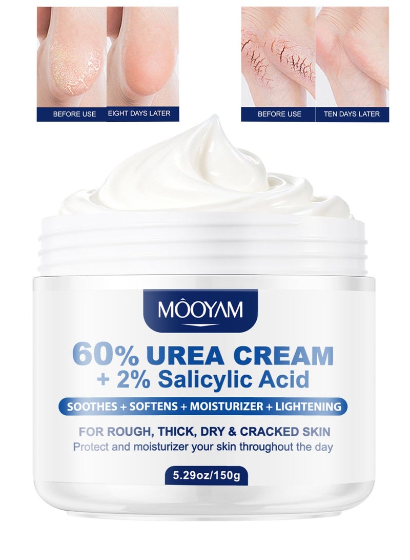 MOOYAM 60% Urea Cream with 2% Salicylic Acid Maximum Strength Treatment Soothes Softens Moisturizes and Lightens Heels Elbows and Hands for Rough Thick Dry and Cracked Skin 150g - Image 1