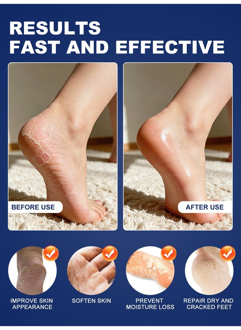 MOOYAM 60% Urea Cream with 2% Salicylic Acid Maximum Strength Treatment Soothes Softens Moisturizes and Lightens Heels Elbows and Hands for Rough Thick Dry and Cracked Skin 150g - Image 4