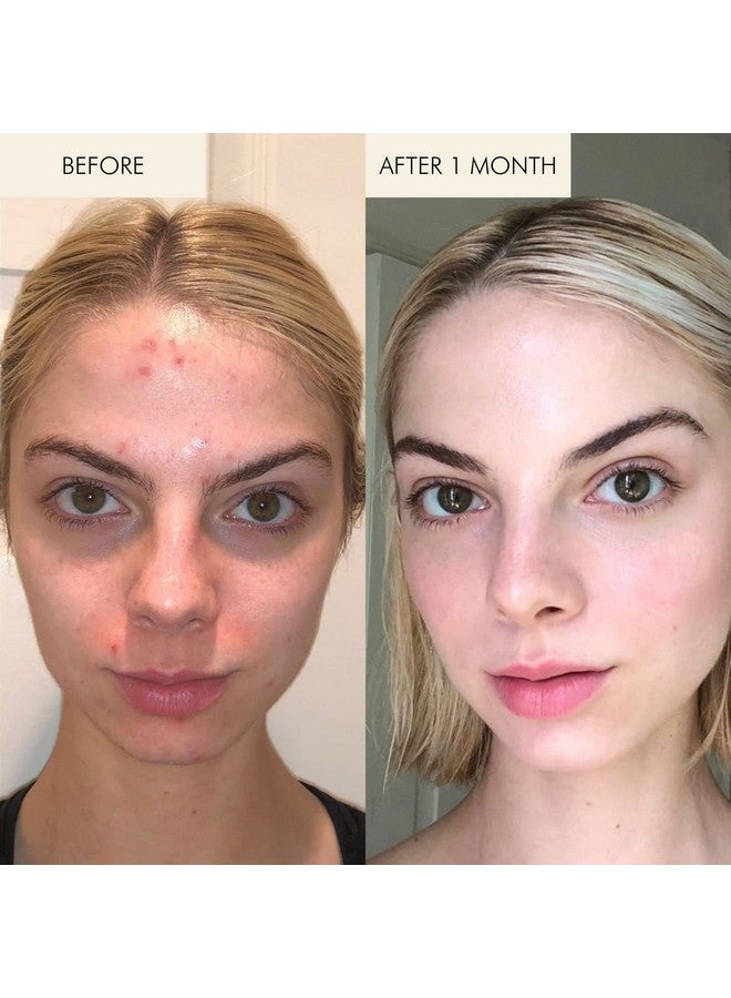 Mara Natural Evening Primrose + Green Tea Algae Retinol Face Oil Nontoxic Plantbased Skin Care Moisturizes + Soothes Skin To Minimizes Look Of Pores + Fine Lines (Travel Size 0.5 Fl Oz 15) - Image 5