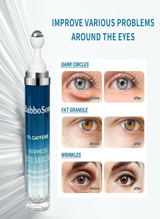 Under Eye Cream for Dark Circles with 5% Caffeine and Retinyl Palmitate, Under Eye Corrector with 360° Roller Massage Ball for Puffy Bags and Fine Lines, 0.76 fl oz - Image 3