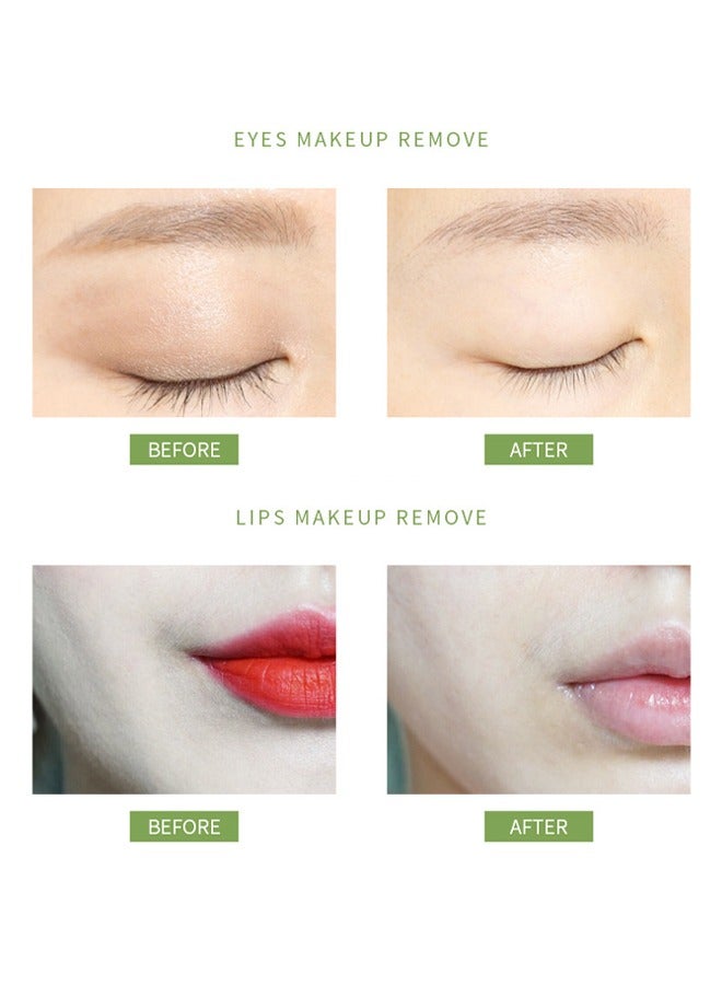 Kiss Beauty Avocado Purifying-Cleansing Balm Makeup Remover, Balm to Oil, Double Cleanse, Acne Face Wash 75g - Image 5