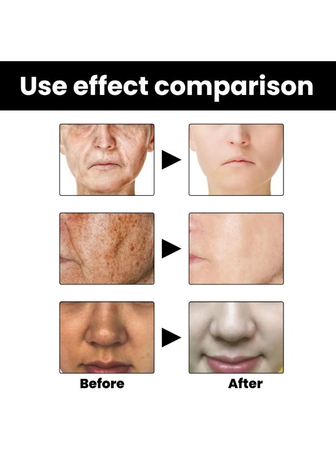 EELHOE سيروم تصحيح الميلانين للوجه للعناية بالبشرة مرطب إصلاح سيروم مصحح بقع داكنة مزيل الميلانين جوهر الوجه للعناية بالبشرة سيروم إصلاح فيتامين سي 30 مل - Image 3
