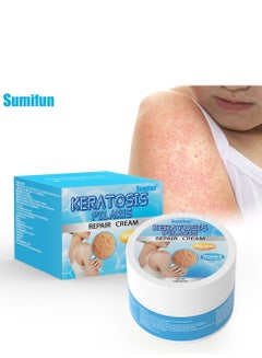 Sumifun Keratosis Pilaris Repair Cream,Vitamin E cream, urea to remove