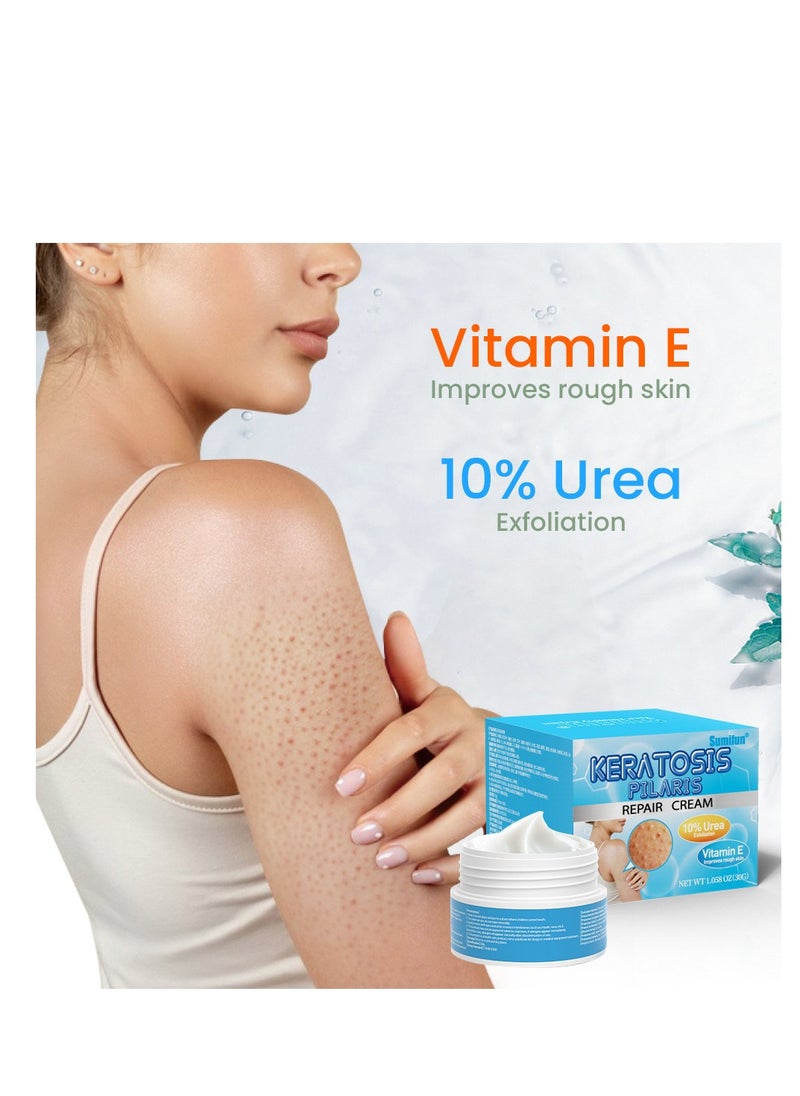 Keratosis Pilaris Repair Cream,Vitamin E cream, urea to remove dead skin cells 30g